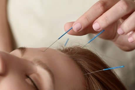 kurs akupunktury kosmetycznej