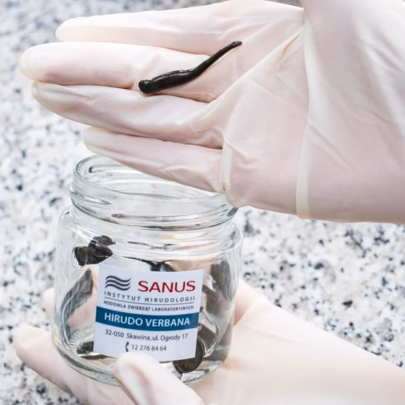 Szkoła Hirudoterapii i Larwoterapii Praktycznej