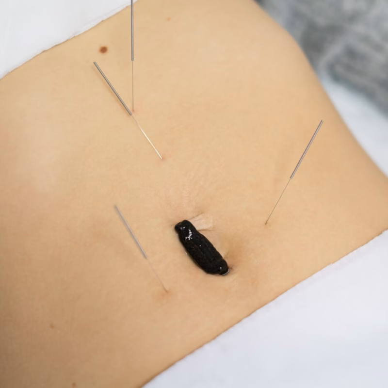 Szkoła Hirudoterapii i Larwoterapii Praktycznej