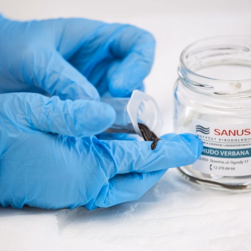 Szkoła Hirudoterapii i Larwoterapii Praktycznej