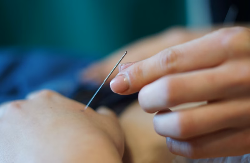 Akupunktura Mistrza Tunga ITCM DAO