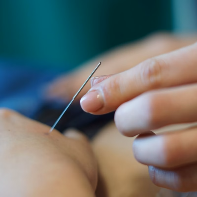 Akupunktura Mistrza Tunga ITCM DAO