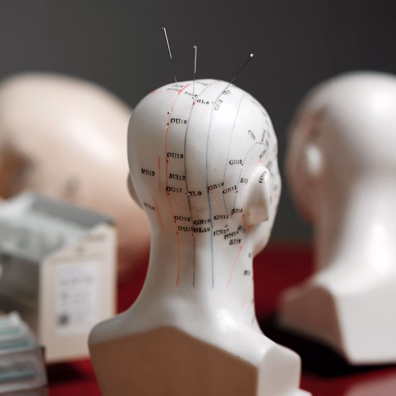 Akupunktura czaszki Yamamoto ITCM DAO