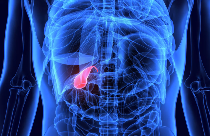 Pęcherzyk żółciowy ITCM DAO