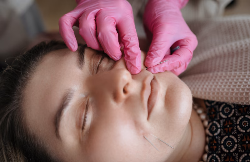 Podstawy akupunktury kosmetycznej ITCM DAO